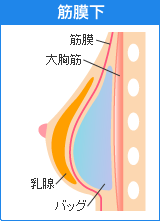 LpC[WCXgR